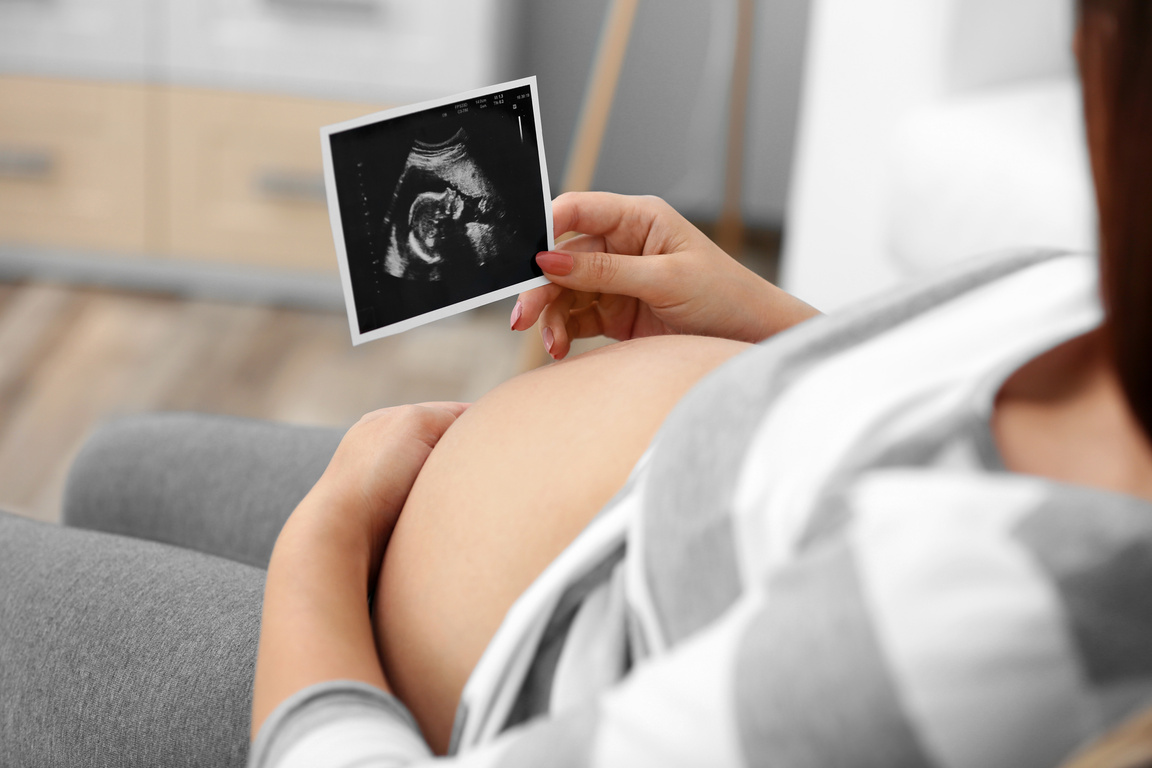 Young Pregnant Woman Looking at Ultrasound Photo